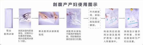 剖腹產(chǎn)