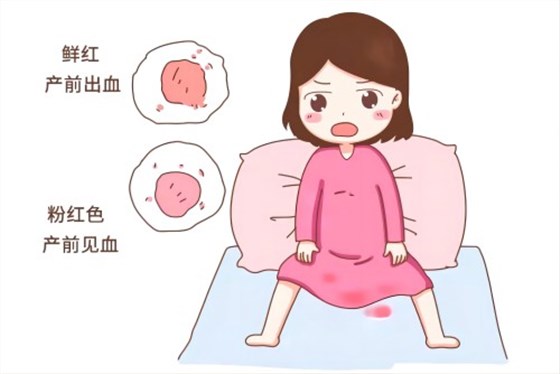 產(chǎn)后出血