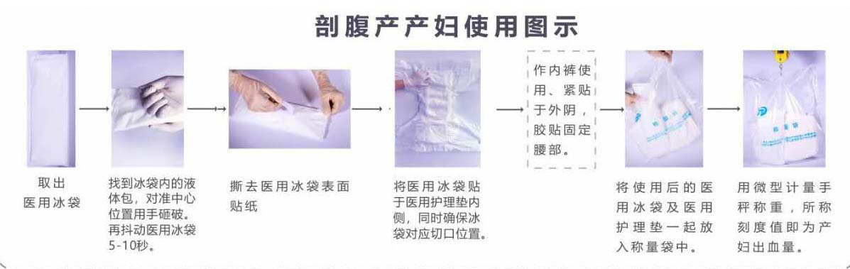 剖腹產(chǎn)